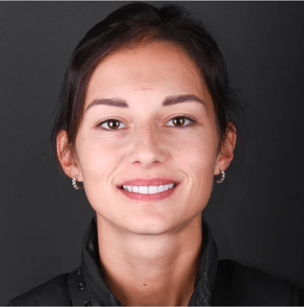 the same photo of the young woman showing perfect teeth as a preview part of smile design analysis