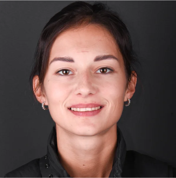 original close-up shot of a young lady with dental discoloration and a malformed tooth shape