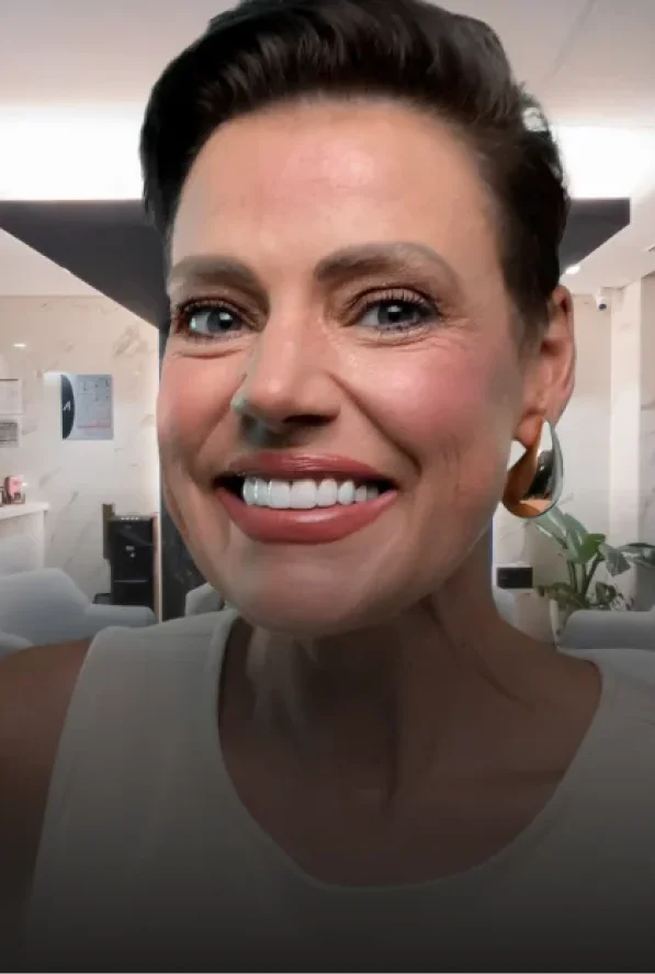 a refined lady exhibiting her new smile