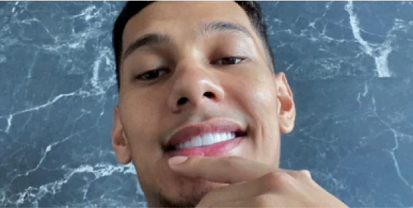 selfie of a proudly man posing his new smile