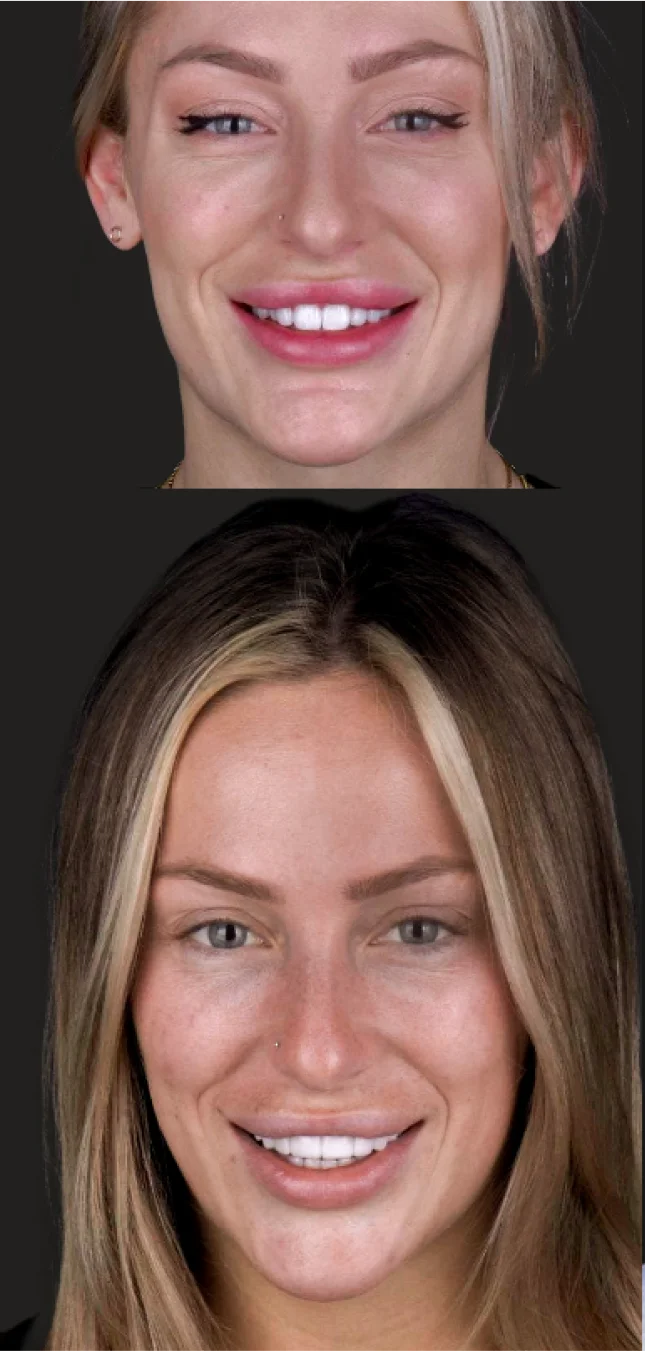 Before and after gallery of multiple patients' smile transformations.