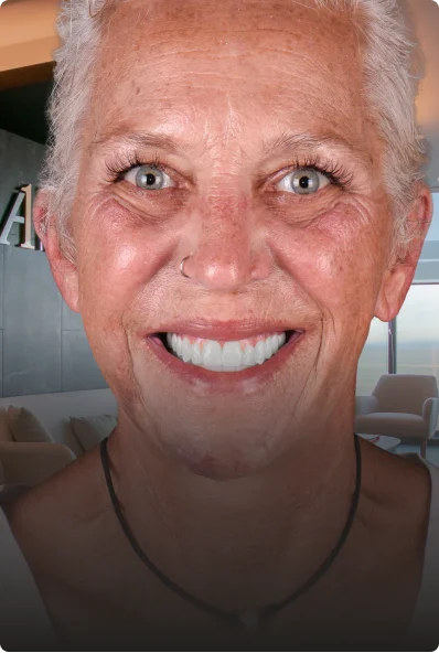middle-aged woman smiling again after all on 4