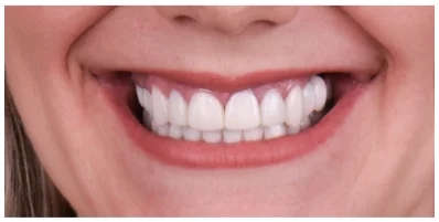A patient at A1 Smile Design, mid-consultation with a cosmetic dentist