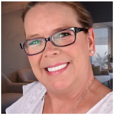 close-up picture of a bad shape smile