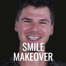 go to smile makeover packages prices