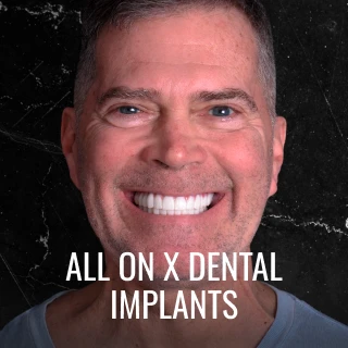 patient with new smile after All on X dental implants in Playa del Carmen