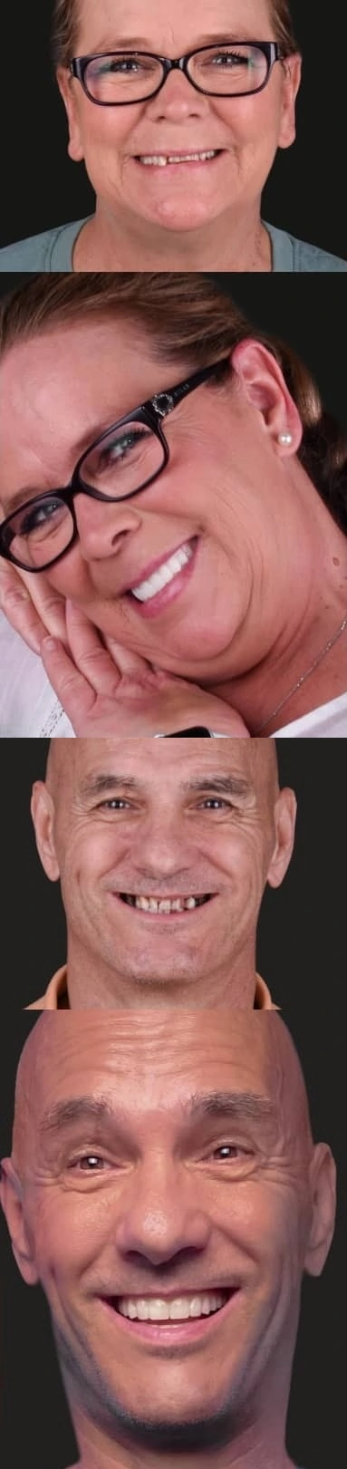 gallery of before and after shots of patients