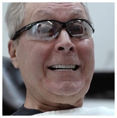 patient after treatment admiring his new smile through a mirror