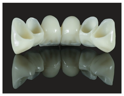 A photo of a dental bridge