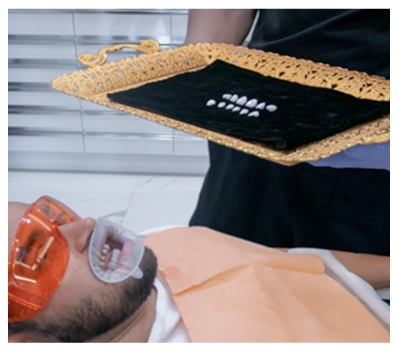 photos showing the various steps of the dental crown procedure.