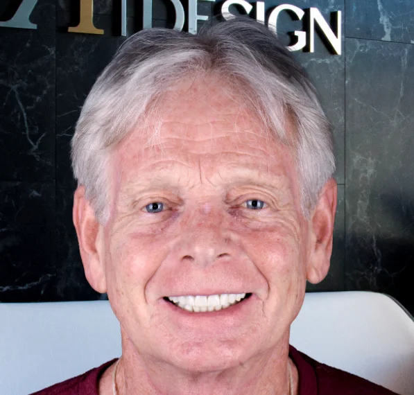 Middle-aged man with restored teeth smiling again
