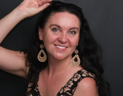 Before image of patient needing emax veneers, uneven and discolored teeth, cosmetic dentistry case, porcelain veneers preparation, smile makeover candidate