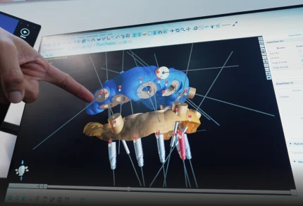 advanced dental technology used at A1 Smile Design clinic