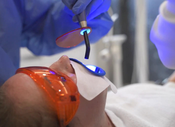 Laser teeth whitening in Playa del Carmen for a brighter and confident smile.