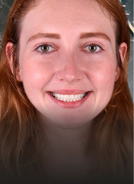 Young woman with natural bright smile showing results of cosmetic dental treatment in Playa del Carmen.