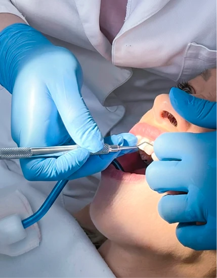 Professional teeth cleaning in Playa del Carmen for optimal oral health.