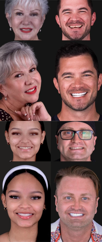 Dental treatment transformations in Mexico from A1 Smile Design reviews