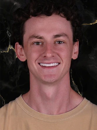 patient portrait after smile makeover at A1 Smile Design