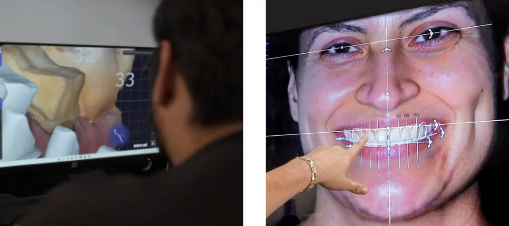 dental patient looking her new smile
