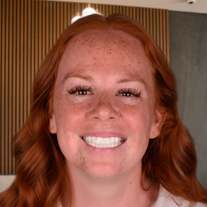 Patient smiling after cosmetic dentistry in Playa del Carmen dental clinic.