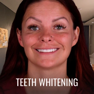 woman smiling after teeth whitening treatment in Playa del Carmen