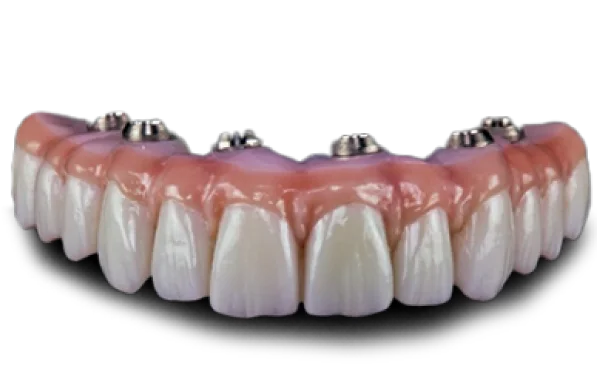 close-up shot of a super structure of an all on 6 treatment