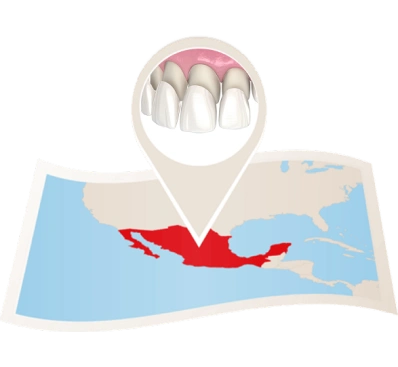Map of Mexico highlighting dental tourism for veneers, cosmetic dentistry in Mexico, affordable porcelain veneers, smile design destination for international patients